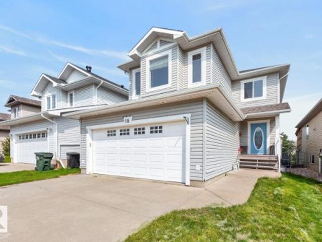 House for sale in Sherwood Park, Alberta