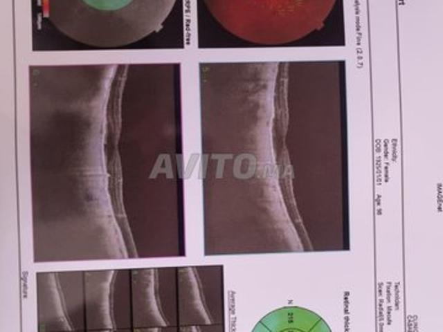 Propriété location à Sidi Rahal, Doukkala-Abda